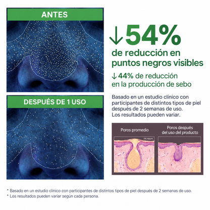 AUVEN™ Mascarilla Facial Burbujeante de Albahaca Sagrada + PHA